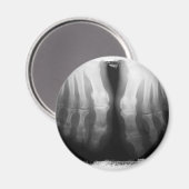 Aimant X-Ray Pieds humains Skeleton Bones noir et blanc (Recto/Verso)