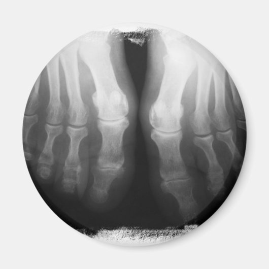 Aimant X-Ray Pieds humains Skeleton Bones noir et blanc (Devant)