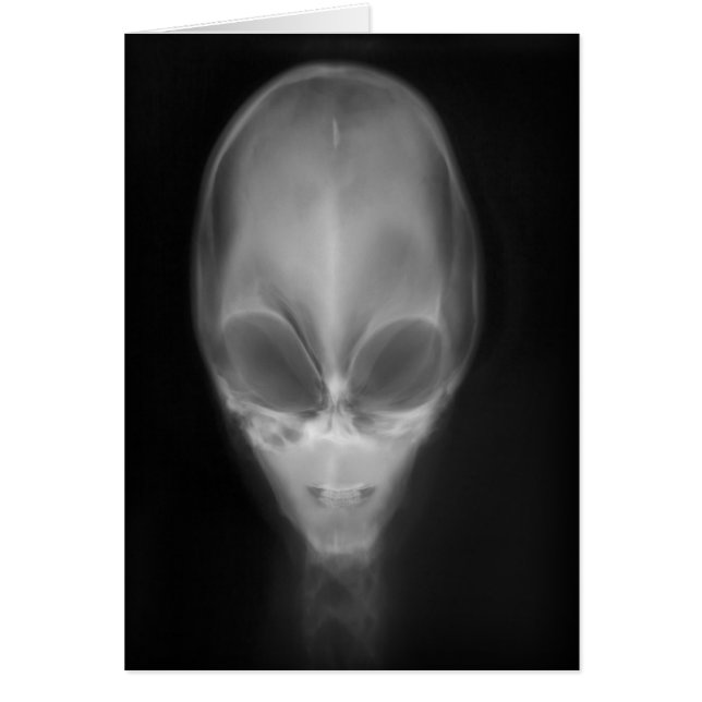 Alien Skull-röntgenfoto (Voorkant)