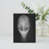Alien Skull-röntgenfoto Briefkaart (Staand voorkant)