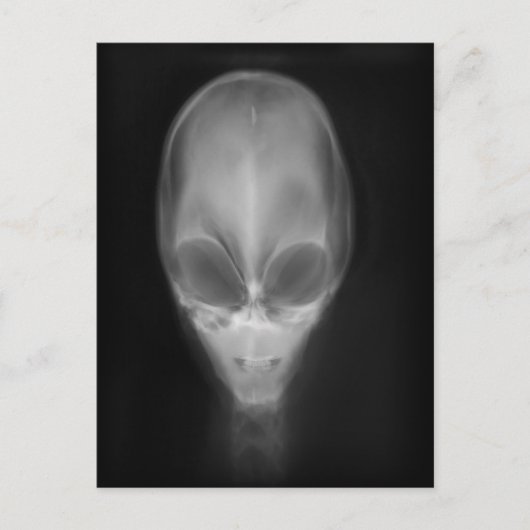 Alien Skull-röntgenfoto Briefkaart (Voorkant)