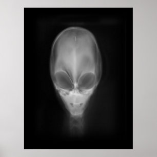 Alien Skull-röntgenfoto Poster