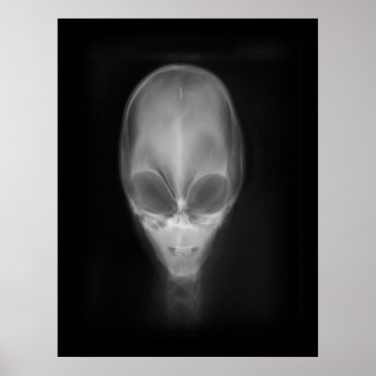 Alien Skull-röntgenfoto Poster (Voorkant)