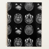Analyse IRM du cerveau (Devant)