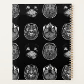 Analyse IRM du cerveau (Dos)