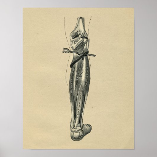 Anatomie de la jambe humaine 1902 Impression Vinta (Devant)