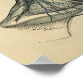 Anatomie du cou de la tête humaine 1902 Impression (Coin)