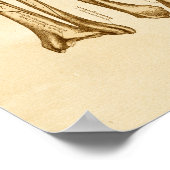  anatomie Illustratie Tibia Fibula Botten Poster (Hoek)