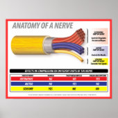 Anatomie van A Nerve 2015 Poster (Voorkant)