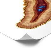 Anatomie van bijnierklier, transversale sectie poster (Hoek)