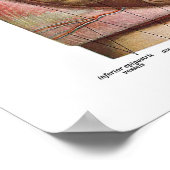 Anatomie van de grote darmen poster (Hoek)