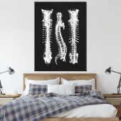 Anatomie van de menselijke wervelkolom Grote Canva Canvas Afdruk (Insitu (Slaapkamer))
