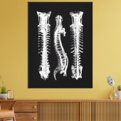 Anatomie van de menselijke wervelkolom Grote Canva Canvas Afdruk (Insitu (Woonkamer))