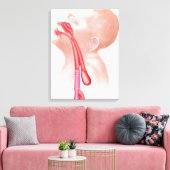 Anatomie van een tracheesophageale fistels canvas afdruk (Insitu (Woonkamer))