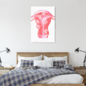 Anatomie van fibroïde tumoren in de baarmoeder van canvas afdruk (Insitu (Slaapkamer))