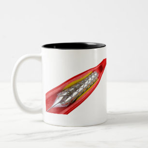 Angioplastiek Tweekleurige Koffiemok