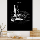 Ankle Anatomie Orthopedic Wall Decor Poster (Keuken)