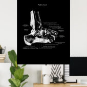 Ankle Anatomie Orthopedic Wall Decor Poster (Thuiskantoor)