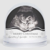 Annonce de grossesse aux grands-parents par échogr (Avant)