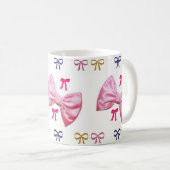 arcs de tasse (Devant droit)