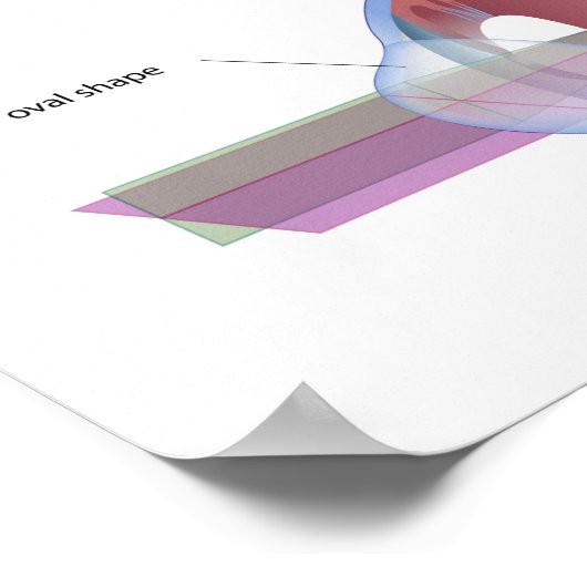 Astigmatisme, un défaut oculaire commun Poster (Coin)