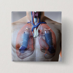 astma vierkante button 5,1 cm