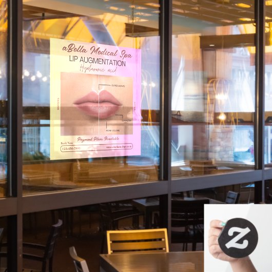 Autocollant Pour Fenêtre Personnaliser Med Spa Lip Augmentation Lip Remplis (Fenêtre du restaurant)