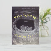 Baby Aankondiging (Staand voorkant)