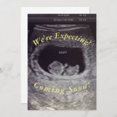 Baby Aankondiging (Voorkant / Achterkant)