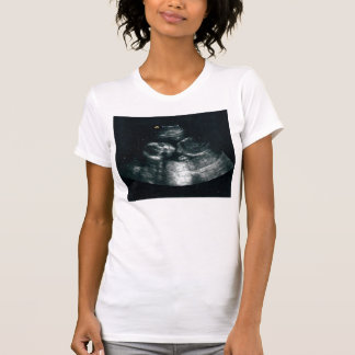 Baby Inside T-shirt