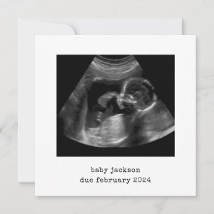 Baby Scan Foto Aankondiging Kaart