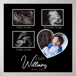 Baby Scan Fotosonogram pasgeborene baby keepsake Poster