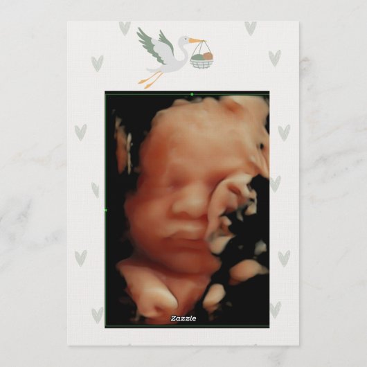 Baby shower - baby boy or gris Invitation Kaart (Achterkant)