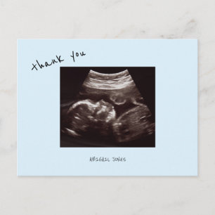 Baby Shower Echografie Schattig Ijsblauw Bedankt Briefkaart