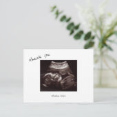 Baby shower Ultrasound Cute Font Dank u Briefkaart (Staand voorkant)