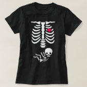 Baby Skeleton Zwangerschap Aankondiging röntgenfot T-shirt (Design voorkant)