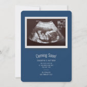 Baby Sonogram Binnenkort bekend (Voorkant)