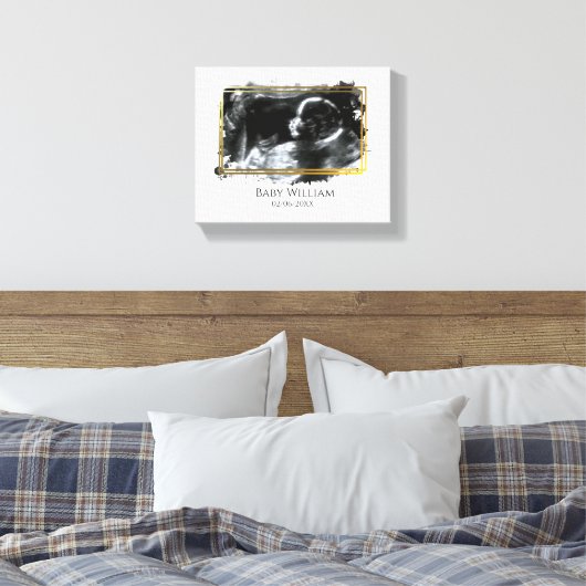 Baby ultrasone Sonogram Afbeelding Verwacht Canvas Afdruk (Insitu (Slaapkamer))