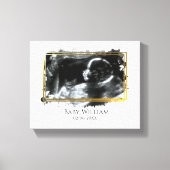 Baby ultrasone Sonogram Afbeelding Verwacht Canvas Afdruk (Voorkant)