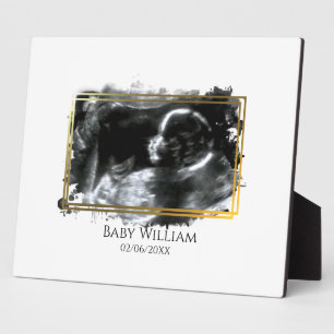 Baby ultrasone Sonogram Afbeelding Verwacht Fotoplaat