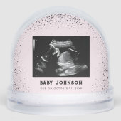 Baby Ultrasound | Sonogram Pregnancy Announcement (Avant)