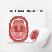 Bacteriële tonsillitis muismat (Met muis)
