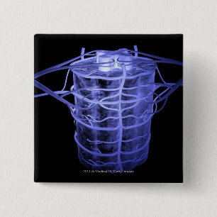 Badge Carré 5 Cm Artères entourant une partie de la colonne