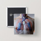 Badge Carré 5 Cm Asthme (Devant & derrière)