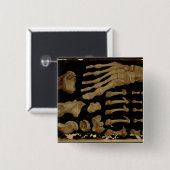 Badge Carré 5 Cm Dessin anatomique des os du pied (Devant & derrière)