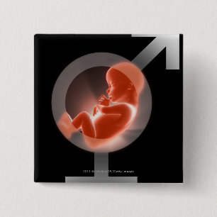 Badge Carré 5 Cm Foetus superposé au-dessus des symboles masculins