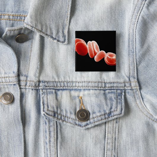Badge Carré 5 Cm Globules rouges (En situation)
