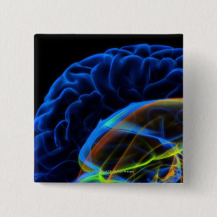 Badge Carré 5 Cm Image de rayon X du cerveau
