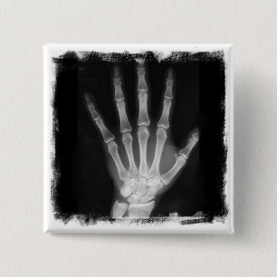 Badge Carré 5 Cm Main de squelette de rayon X de B&W