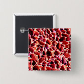 BADGE CARRÉ 5 CM PEBLES DE PLAGE (Devant & derrière)